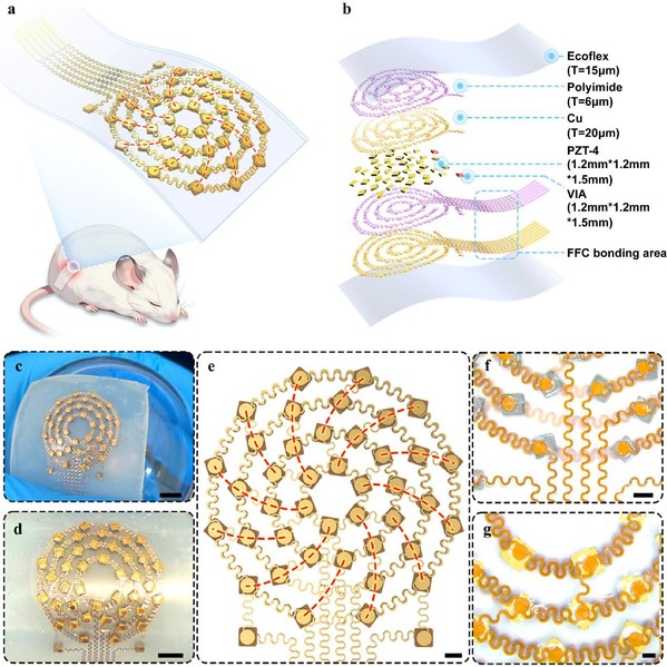 生医工学院彭畅课题组开发柔性超声贴片突破糖尿病神经痛治疗难题